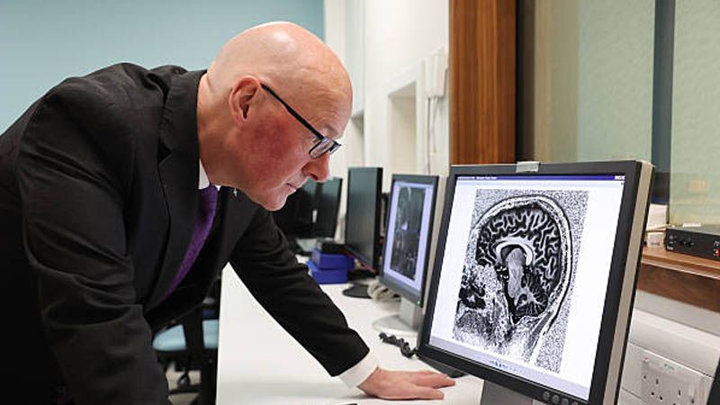 Scientists Reveal Brain before Die